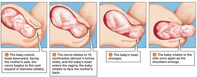 Stages of labor and delivery
