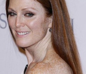 Freckles example