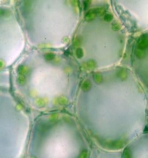 Microscopic view of parenchyma cells with chloroplasts