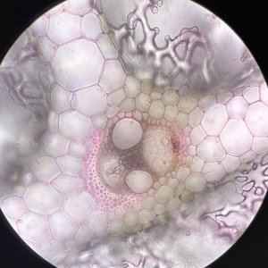 Starch storage tissue in potatoes (parenchyma)