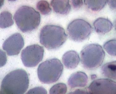 Microscopic view of collenchyma cells