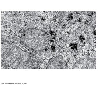 Glycogen granules in animal cells