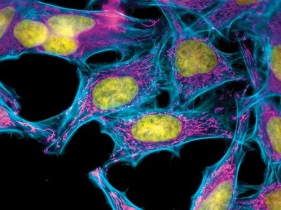 Fluorescent micrograph of eukaryotic cells showing nuclei and cytoskeleton