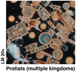 Protists (light micrograph)