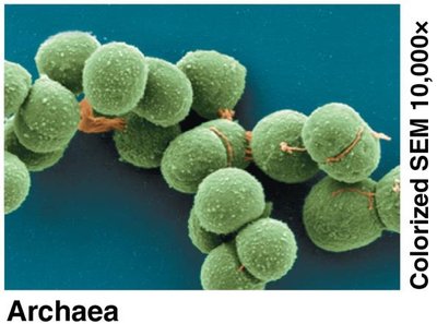 Archaea (SEM image)
