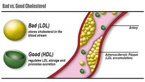 Bad vs. good cholesterol diagram
