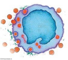 HIV infecting a human helper T cell