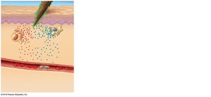 Step 1: Tissue injury and signaling molecule release