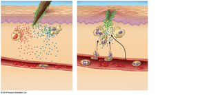 Step 2: Capillaries widen, neutrophils migrate