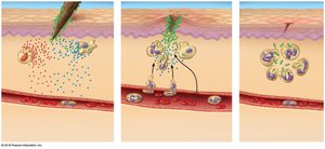 Step 3: Neutrophils digest bacteria, tissue heals