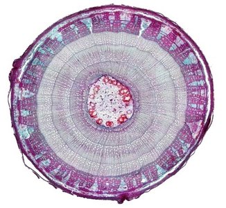 Cross-section of a woody stem showing annual rings