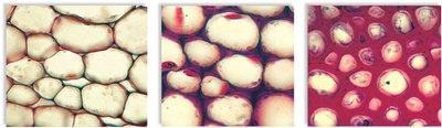 Microscopic images of parenchyma, collenchyma, and sclerenchyma cells