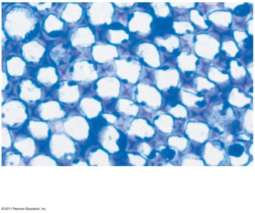 Collenchyma cells in Helianthus stem