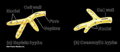 Diagram of septate and coenocytic hyphae