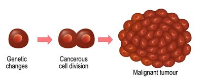 Genetic changes leading to malignant tumour formation
