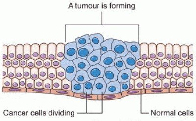 Tumor formation: cancer cells dividing among normal cells