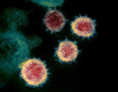 Electron micrograph of SARS-CoV-2