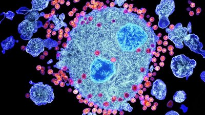 HIV particles budding from an immune cell