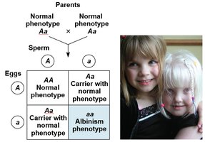 Inheritance of albinism
