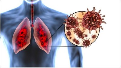 Covid-19 virus and lungs