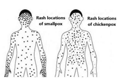 Inoculation for immunity