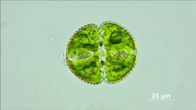 Cosmarium sp. (Desmid) under microscope