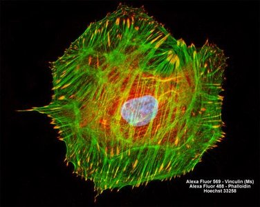 Fluorescent micrograph of cytoskeleton in a cell