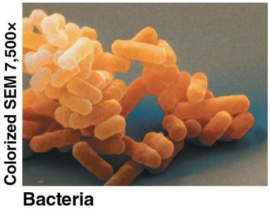 Bacteria