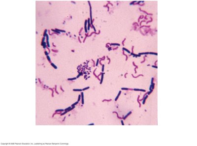 Gram stain of bacteria