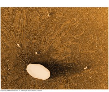 Prokaryotic cell with plasmids