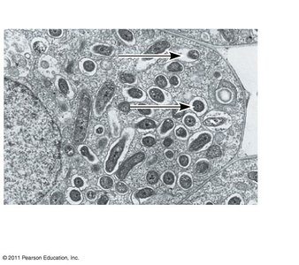 Rhizobium in root cell