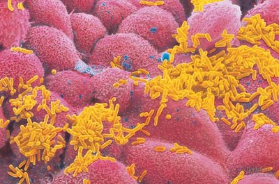 Bacteria in the human intestine