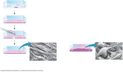 Anchorage dependence and density-dependent inhibition