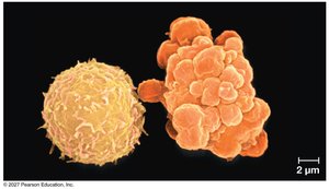 Apoptosis of a human white blood cell