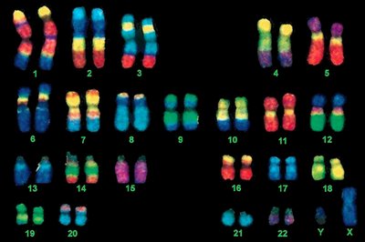 Human karyotype with chromosomes labeled