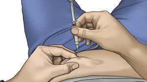 Subcutaneous injection