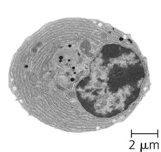 Plasma cell (effector B cell)