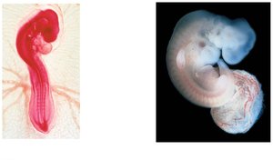 Vergelijking van embryo's van kip en mens