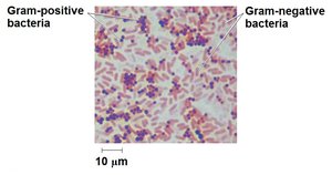 Gram stain of bacteria