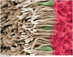 Micrograph of prokaryotic cell surface structures