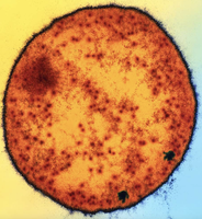 Diagram of an archaeal cell