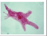Microscopic image of an amoeba