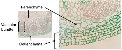 Collenchyma and parenchyma cells with vascular bundle