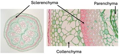 Sclerenchyma, collenchyma, and parenchyma cells