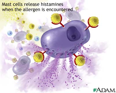 Mast cell releasing histamines in response to allergen