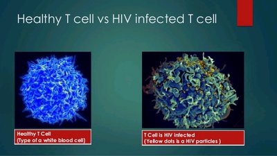 Healthy T cell vs HIV-infected T cell