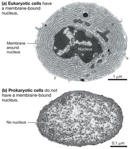 Comparison of eukaryotic and prokaryotic cell structure