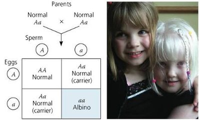 Punnett square for recessive disorder and photo of affected child