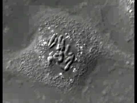 Chromosomes visible during mitosis under microscope