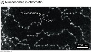 Nucleosomes in chromatin (electron micrograph)